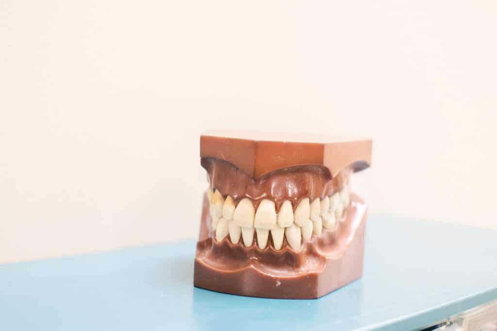 does teeth whitening work on dentures