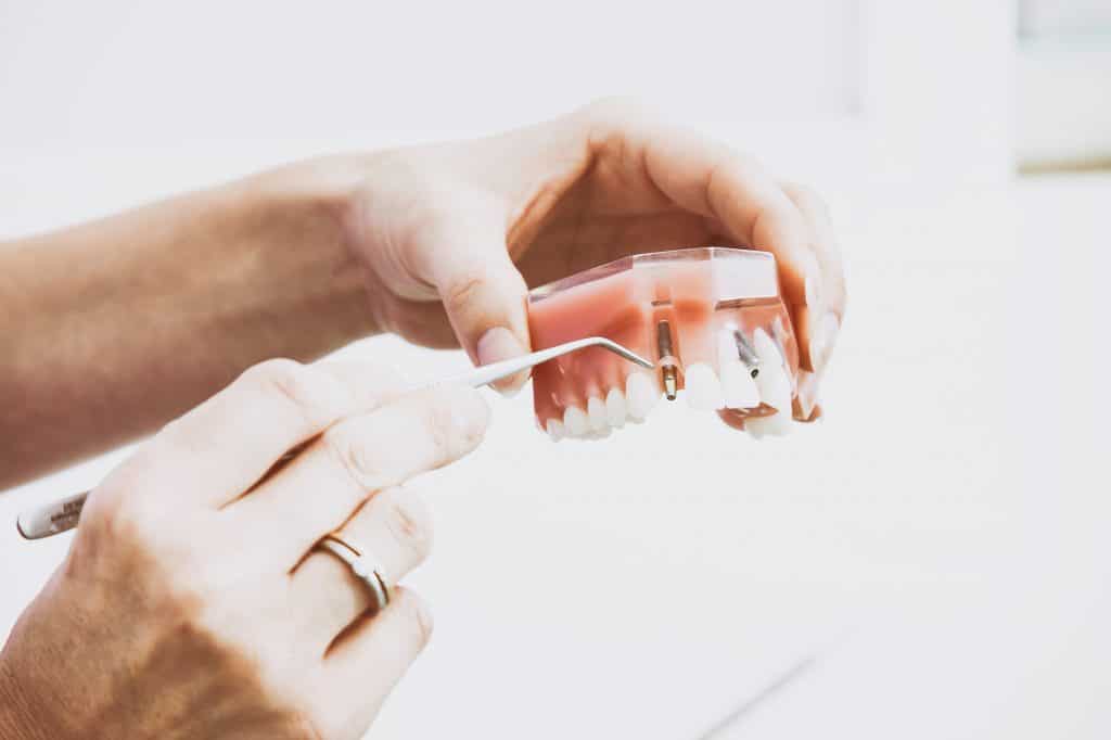 5 Denture Care Tips