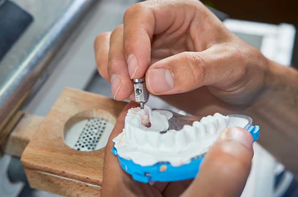 Denture Implant Consultations