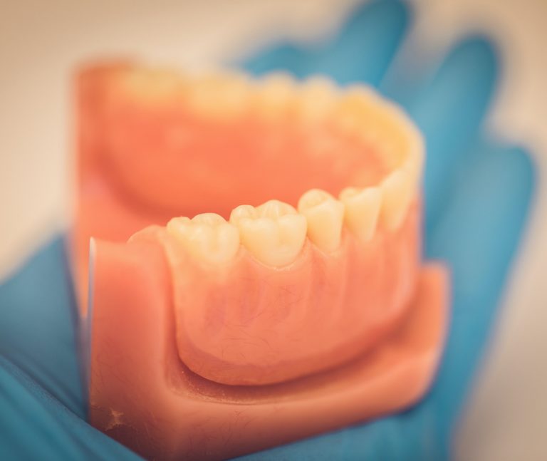 Lower Suction Dentures Denture Services Red Deer