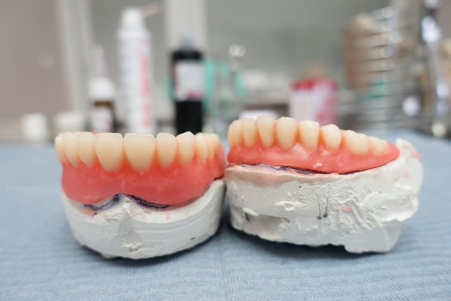 Things To Know Before Getting Dentures